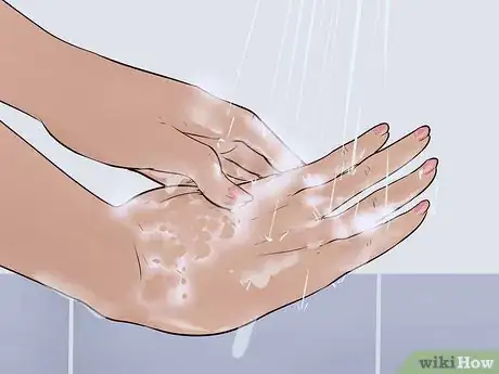 Imagen titulada Help a Male Child Provide a Urine Sample Step 18