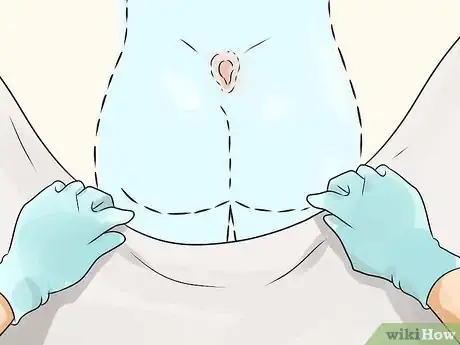 Imagen titulada Get Rid of a Cyst Step 13