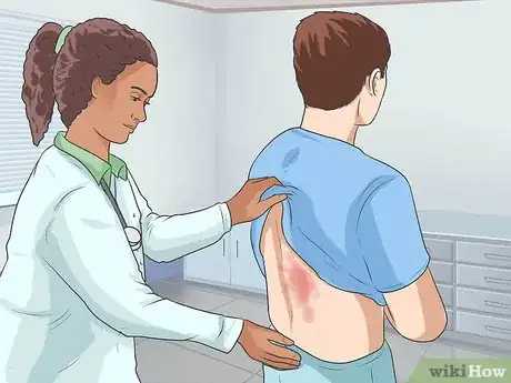 Imagen titulada Diagnose Psoriasis Step 8