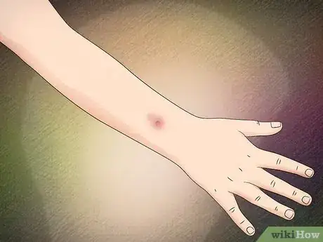 Imagen titulada Identify a Brown Widow Spider Step 11