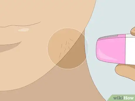 Imagen titulada Make Epilating Hurt Less Step 11