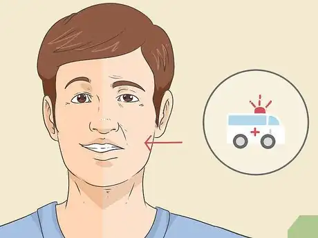 Imagen titulada Treat Droopy Eyelids Step 4