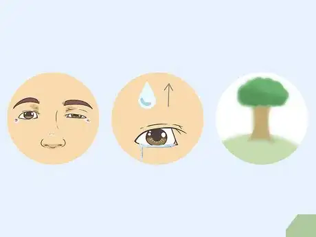 Imagen titulada Treat Droopy Eyelids Step 7