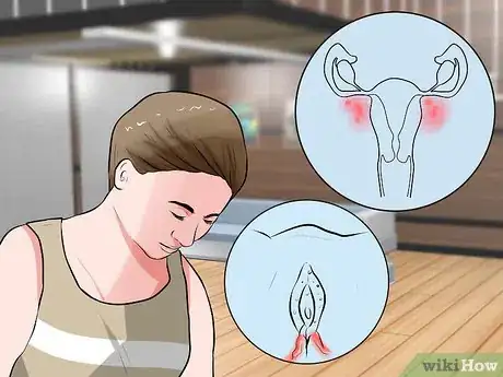 Imagen titulada Recognize Vulva Cancer Symptoms Step 4
