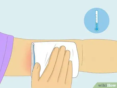 Imagen titulada Remove Nexplanon Step 11