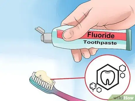 Imagen titulada Clean Teeth With Braces Step 2