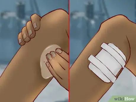 Imagen titulada Treat a Snake Bite Step 14