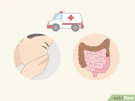 Imagen titulada Treat a Hernia at Home Step 14