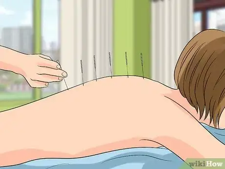 Imagen titulada Relieve Pain from Clavicle Fracture Step 11