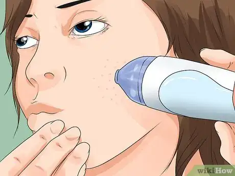 Imagen titulada Use a Blackhead Vacuum Step 3