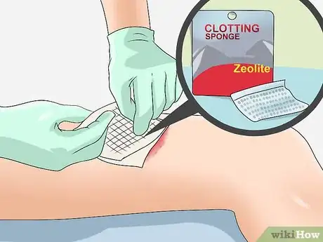 Imagen titulada Make Blood Coagulate Faster Step 3