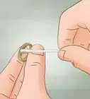 curar sarpullido situado bajo un anillo