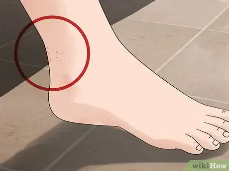 Imagen titulada Detect Fleas Step 9