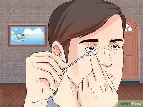 Imagen titulada Remove a Speck From Your Eye Step 4