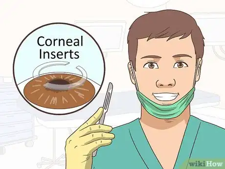 Imagen titulada Cure Keratoconus Naturally Step 10