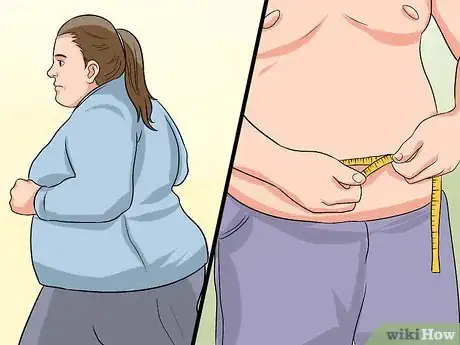 Imagen titulada Push a Hernia Back in Step 14