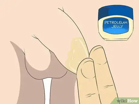 Imagen titulada Free a Penis from a Stuck Zipper Step 6