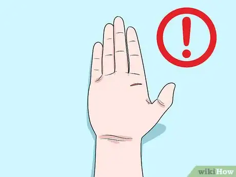 Imagen titulada Prevent Cellulitis Step 1