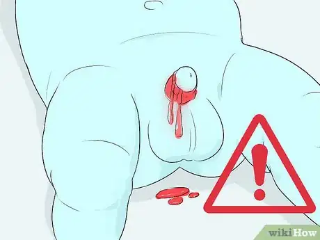 Imagen titulada Clean a Circumcision Step 12
