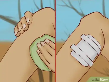 Imagen titulada Treat a Snake Bite Step 6