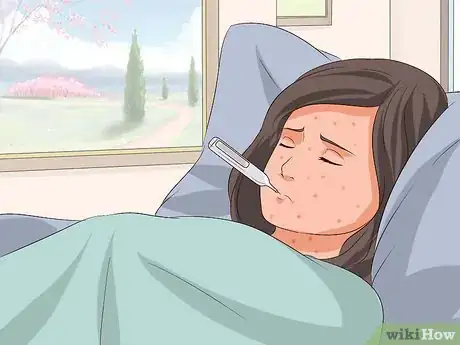 Imagen titulada Recognize Chickenpox Step 18