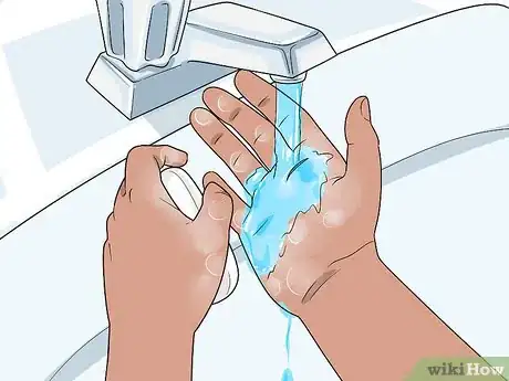 Imagen titulada Prevent Cellulitis Step 2