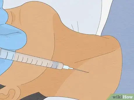 Imagen titulada Fix Torticollis Step 5