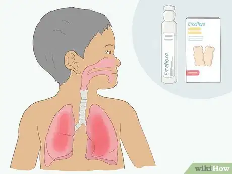 Imagen titulada Take Erceflora Step 2