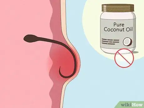 Imagen titulada Shave Your Bikini Area with Coconut Oil Step 15
