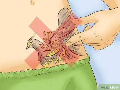 Imagen titulada Get Rid of Tattoo Scarring and Blowouts Step 13