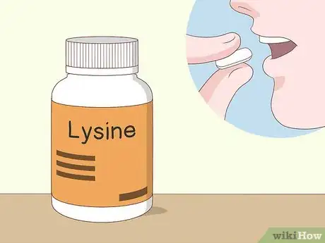 Imagen titulada Get Rid of a Cold Sore Step 16