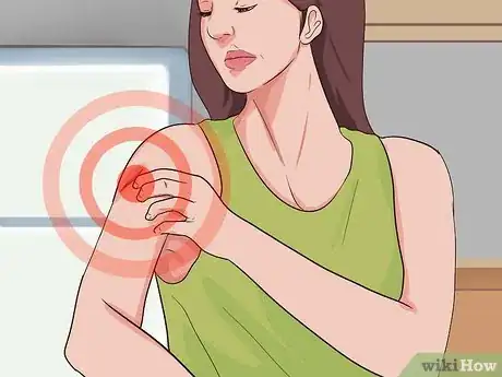 Imagen titulada Check a Wound for Infection Step 9