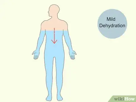 Imagen titulada Reduce Foamy Urine Step 4