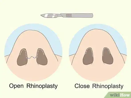 Imagen titulada Fix a Crooked Nose Step 4