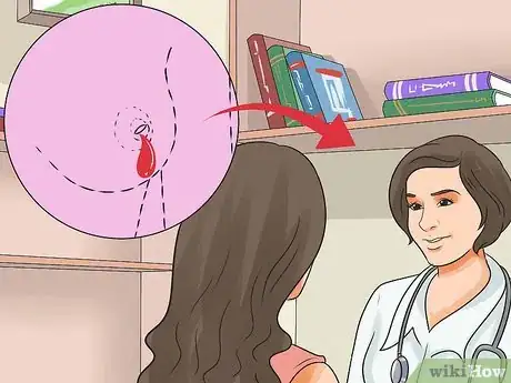 Image intitulée Heal a Cracked Nipple when Breastfeeding Step 8