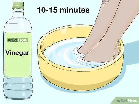 Image intitulée Kill Fungus Step 16