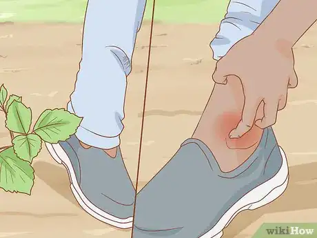 Image intitulée Get Rid of Poison Ivy Rashes Step 2
