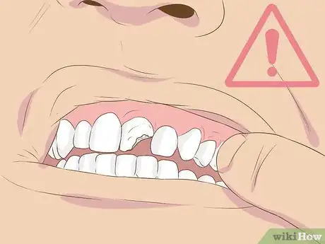Image intitulée Make Fake Braces or a Fake Retainer Step 20