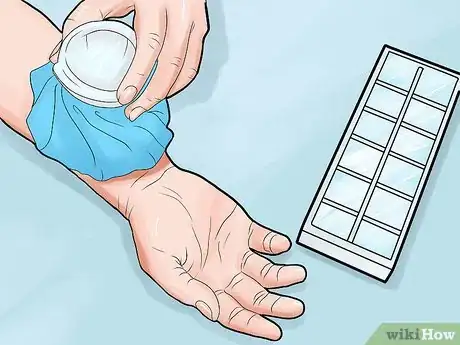 Image intitulée Heal Mosquito Bites Step 2