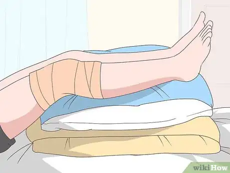 Image intitulée Reduce Swelling After Knee Surgery Step 1