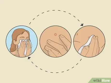 Image intitulée Get Rid of a Pimple Using Toothpaste Step 11
