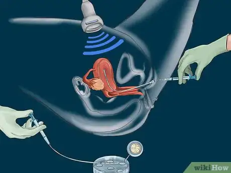 Image intitulée Prepare for in Vitro Fertilization Step 8