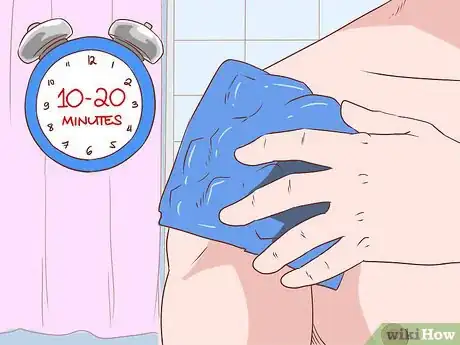 Image intitulée Recover from a Strained or Pulled Muscle Step 2