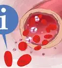 augmenter votre taux de globules rouges