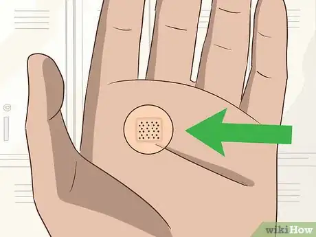 Image intitulée Treat Palmer Warts Step 11