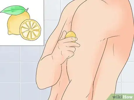 Image intitulée Treat Eczema Naturally Step 14