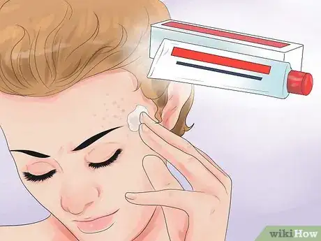 Image intitulée Have an Acne Free Face Step 35