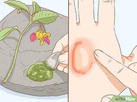 Image intitulée Get Rid of Poison Ivy Rashes Step 6
