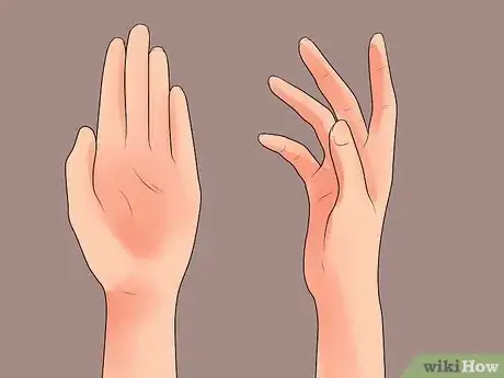 Image intitulée Avoid a Stomach Virus After Being Exposed Step 22