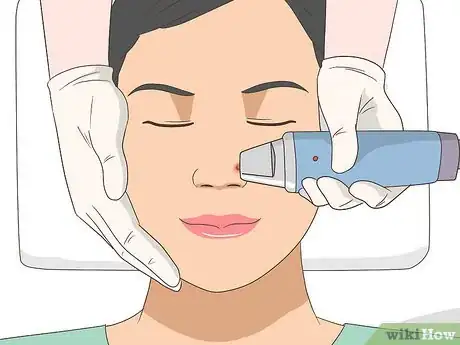 Image intitulée Shrink Pimples Step 13